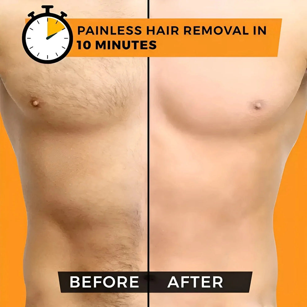 Sydonic Permanent Hair Removal Cream For Men & Women